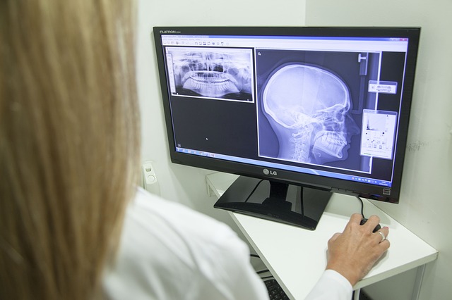 digitális panoráma röntgen